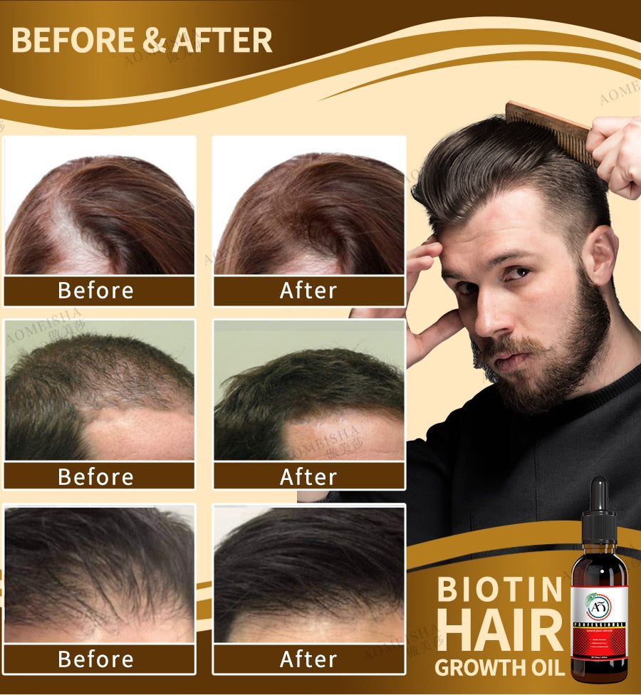 Powerful hair growth Anti-hair loss Anti-baldness Fast hair growth Hair loss treatment Hair regrowth Fast Hair Growth Oil