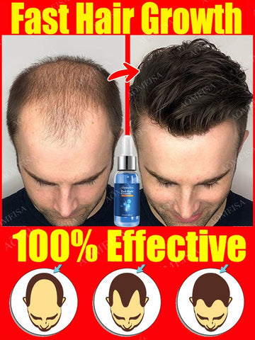 Fast Hair Growth Hair Growth Oil Effective Baldness Repair Hereditary Hair Loss Postpartum Hair Loss Seborrheic Hair Anti Loss