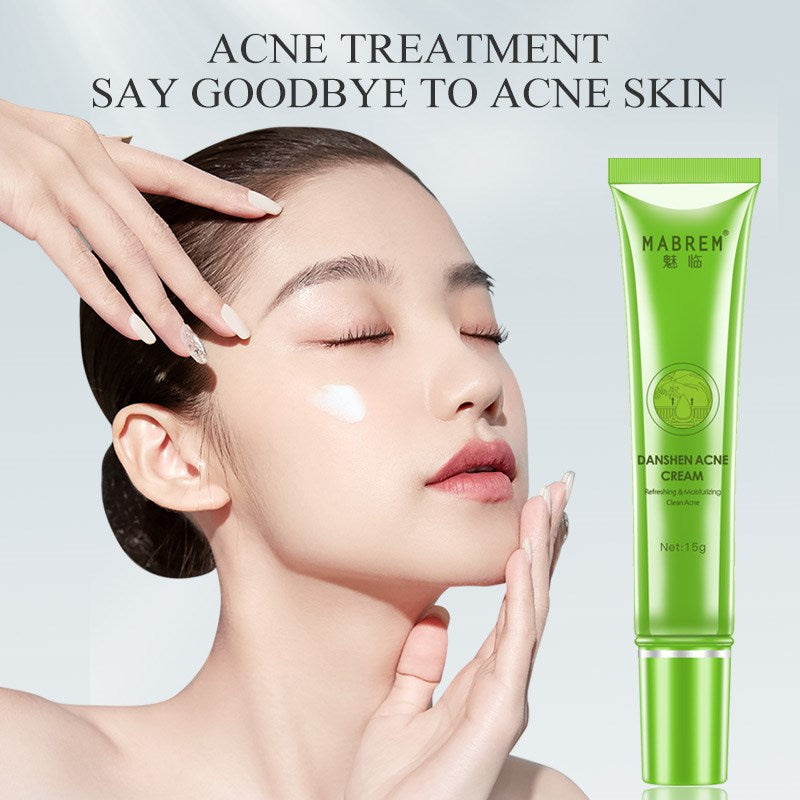 Effective Acne Removal Cream Acne Treatment Fade Acne Spots Oil Control Shrink Pores Whitening Moisturizing Acne Cream Skin Care