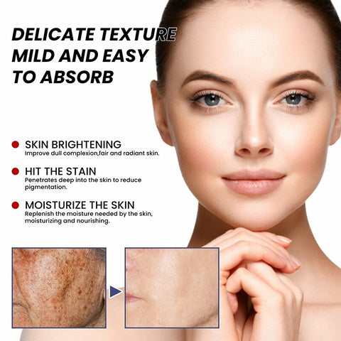 Freckle Whitening Cream Black Dots Melasma Remover Anti Brown Stain Lighten Pigmentation Moisturizing Skin Care Products 2023