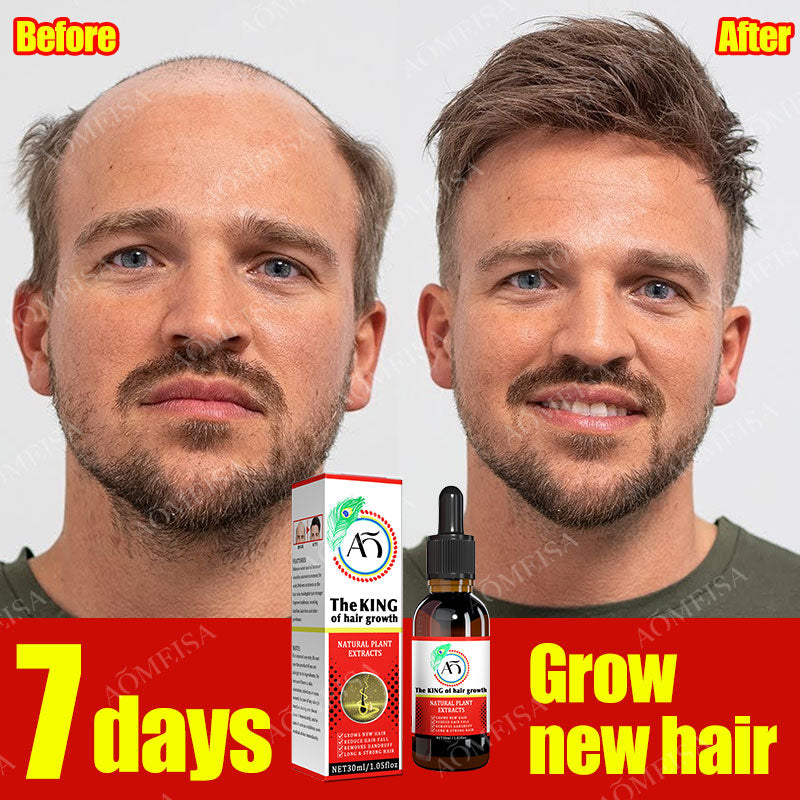 Powerful hair growth Anti-hair loss Anti-baldness Fast hair growth Hair loss treatment Hair regrowth Fast Hair Growth Oil