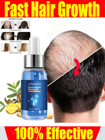 Aceite para el crecimiento rápido del cabello, reparación efectiva de la calvicie, pérdida de cabello hereditaria, pérdida de cabello posparto, antipérdida de cabello seborreico 